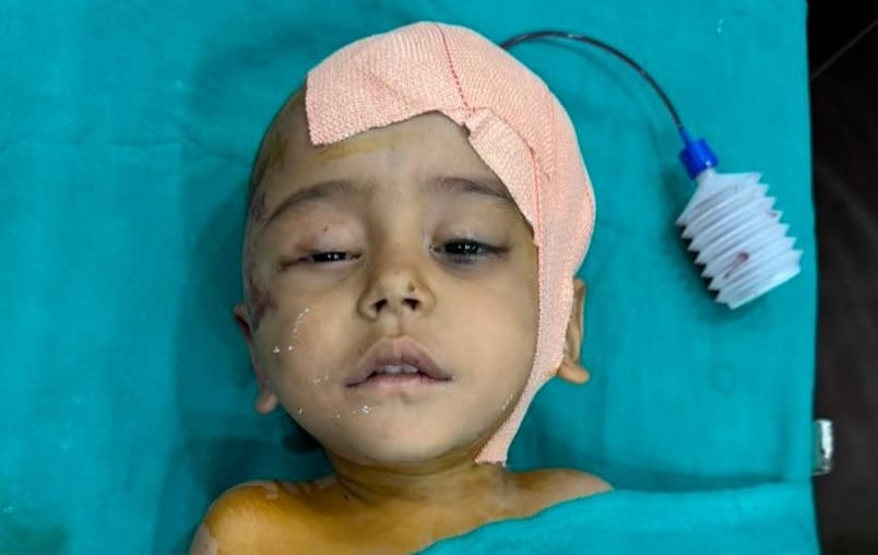 ,ट्रैक्टर हादसे में मासूम के सिर में धंसी हड्डी, महेश्वरम हॉस्पिटल में हुई सफल न्यूरोसर्जरी