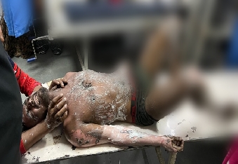 देवली , शहर के अजमेर-कोटा बाईपास स्थित एक होटल की छत पर शुक्रवार को काम करने गया एक युवक बिजली की चप�