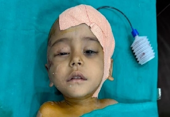 ,ट्रैक्टर हादसे में मासूम के सिर में धंसी हड्डी, महेश्वरम हॉस्पिटल में हुई सफल न्यूरोसर्जरी